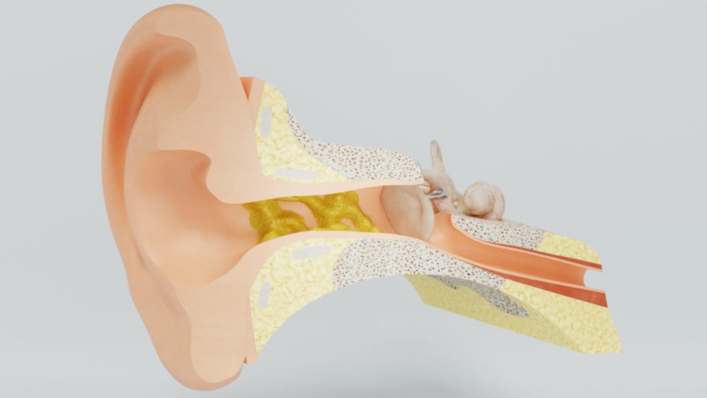 Ear Wax Blockage